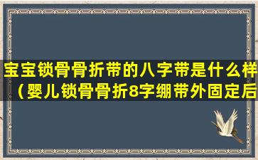 宝宝锁骨骨折带的八字带是什么样（婴儿锁骨骨折8字绷带外固定后注意事项有哪些）