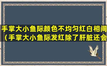 手掌大小鱼际颜色不均匀红白相间（手掌大小鱼际发红除了肝脏还会是什么问题）